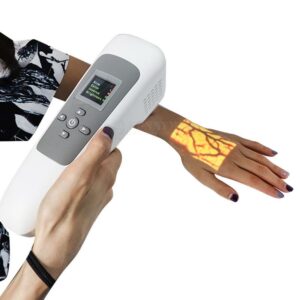 FindaVein Device