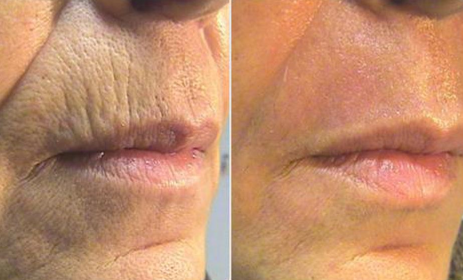 Skinsetics Aesthetic and Medical Devices Machines Skincare Anti-ageing high quality