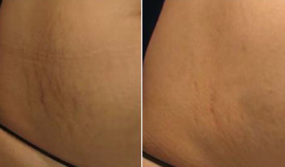 Skinsetics Aesthetic and Medical Devices Machines Skincare Anti-ageing high quality