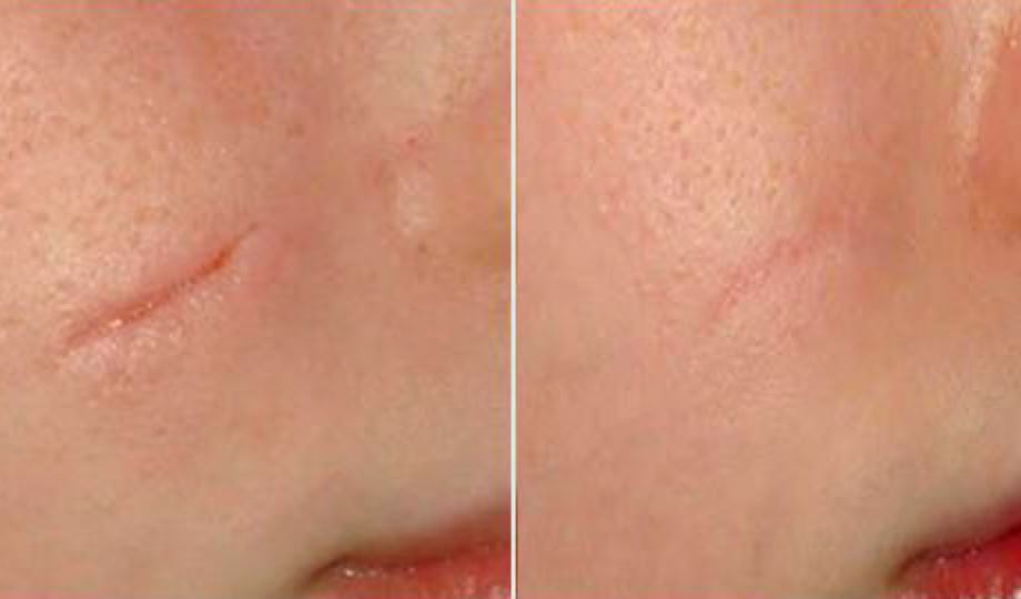 Skinsetics Aesthetic and Medical Devices Machines Skincare Anti-ageing high quality